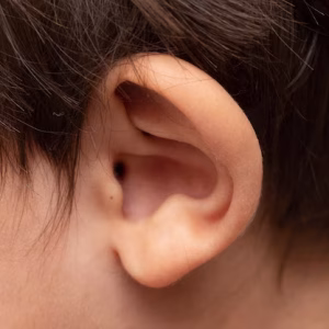 علائم ماستوئیدیت